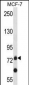 APLP2 Antibody (C-term)
